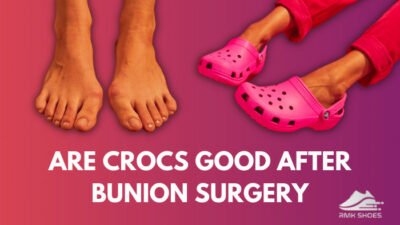 are-crocs-good-after-bunion-surgery
