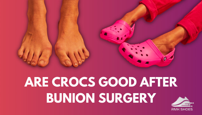 are-crocs-good-after-bunion-surgery