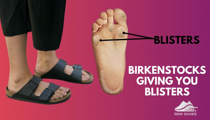 birkenstocks-giving-me-blister