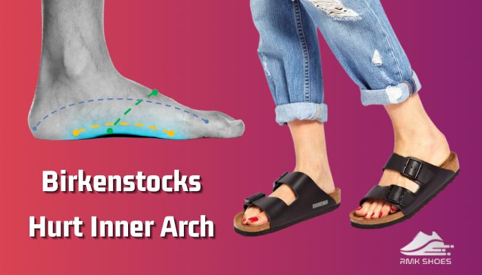 birkenstocks-hurt-inner-arch