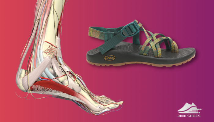 chacos-are-good-for-plantar-fasciitis