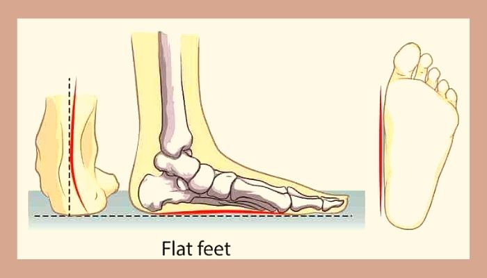 Are Dansko Good For Flat Feet? [Complete Guide 2024]