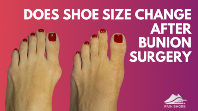 does-shoe-size-change-after-bunion-surgery