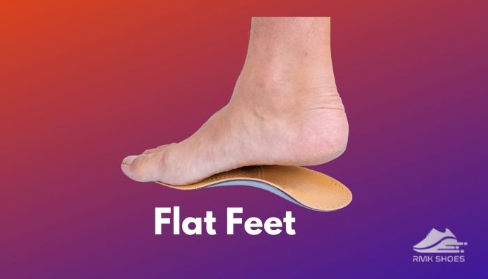 flat-feet