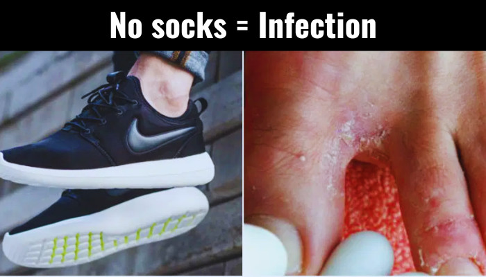 sockless-shoes-causes-bacteria