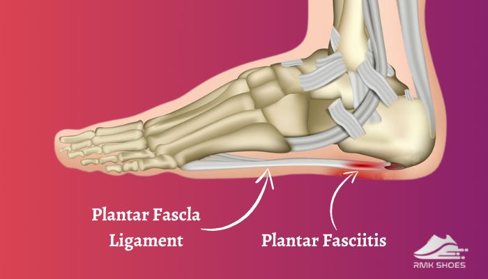what-are-the-causes-and-symptoms-of-plantar-fasciitis